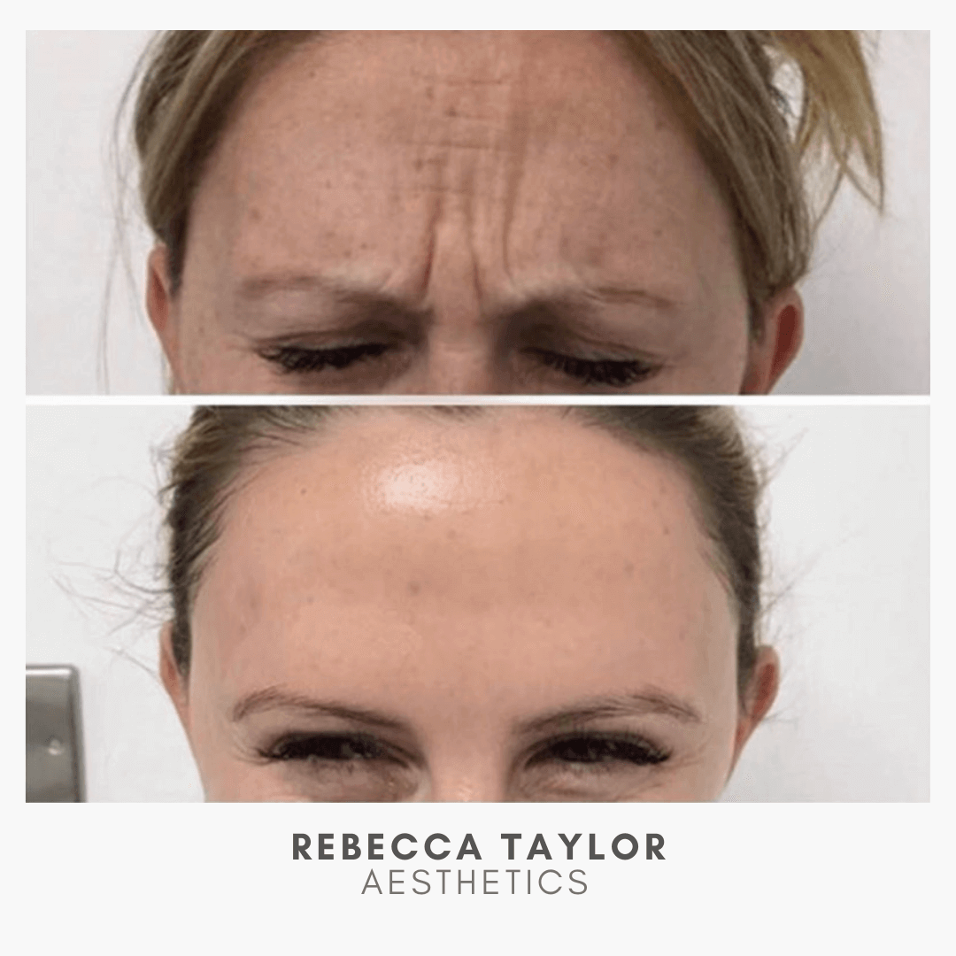 Rebecca Taylor Aesthetics Clinic in Suffolk